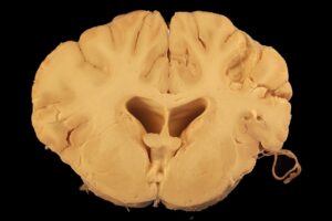 Votre cerveau déforme la réalité : découvrez pourquoi notre perception quotidienne est incomplète et ses implications humaines